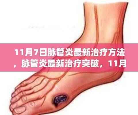 革新疗法引领未来,脉管炎最新治疗突破
