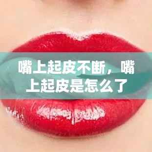 嘴上起皮不断，嘴上起皮是怎么了 