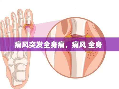 痛风突发全身痛，痛风 全身 