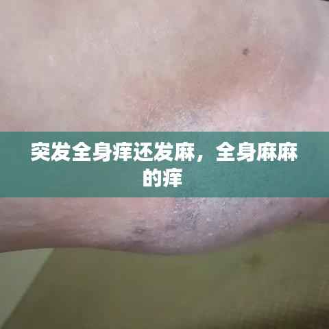 突发全身痒还发麻,全身麻麻的痒