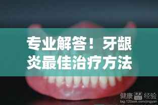 专业解答!牙龈炎最佳治疗方法,轻松解决牙齿疼痛问题!